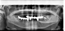 צילום פנורמי לפני הטיפול